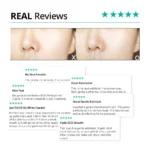 Dr.G  Brightening Peeling Gel (120g 4.23 oz.) Derma peeling solution for Sensitive Skin for Dr.G - Image 6